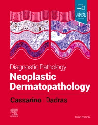 Diagnostic Pathology: Neoplastic Dermatopathology (Hardback) 9780323798266