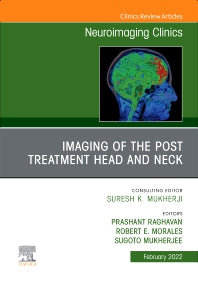 Imaging of the Post Treatment Head and Neck, An Issue of Neuroimaging Clinics of North America (Hardback) 9780323798433