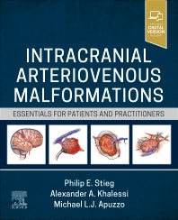 Intracranial Arteriovenous Malformations; Essentials for Patients and Practitioners (Hardback) 9780323825306