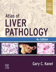 Atlas of Liver Pathology (Hardback) 9780323825337