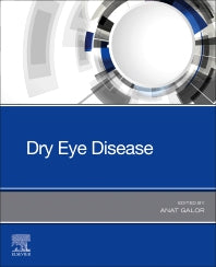 Dry Eye Disease (Paperback / softback) 9780323827539