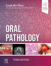 Oral Pathology (Hardback) 9780323829182