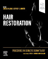 Procedures in Cosmetic Dermatology: Hair Restoration (Hardback) 9780323829212