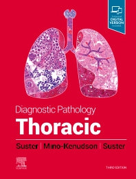 Diagnostic Pathology: Thoracic (Hardback) 9780323834766
