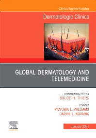 Global Dermatology and Telemedicine, An Issue of Dermatologic Clinics (Hardback) 9780323835541