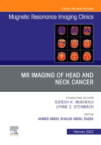 MR Imaging of Head and Neck Cancer, An Issue of Magnetic Resonance Imaging Clinics of North America (Hardback) 9780323835664