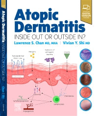 Atopic Dermatitis: Inside Out or Outside In (Hardback) 9780323847445