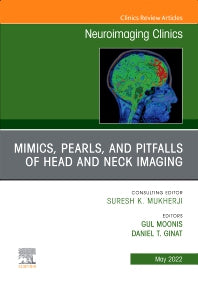 Mimics, Pearls and Pitfalls of Head & Neck Imaging, An Issue of Neuroimaging Clinics of North America (Hardback) 9780323848541