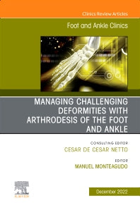 Managing Challenging deformities with arthrodesis of the foot and ankle, An issue of Foot and Ankle Clinics of North America (Hardback) 9780323849463