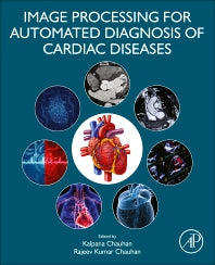 Image Processing for Automated Diagnosis of Cardiac Diseases (Paperback / softback) 9780323850643