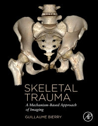 Skeletal Trauma; A Mechanism-Based Approach of Imaging (Hardback) 9780323854757