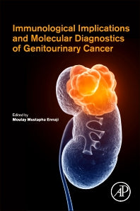 Immunological Implications and Molecular Diagnostics of Genitourinary Cancer (Paperback / softback) 9780323854962