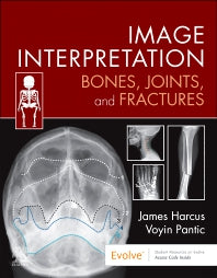 Image Interpretation: Bones, Joints, and Fractures (Paperback / softback) 9780323870801