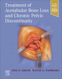 Treatment of Acetabular Bone Loss and Chronic Pelvic Discontinuity (Hardback) 9780323875509