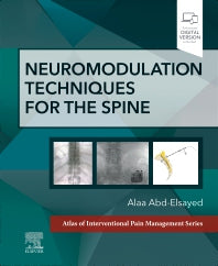Neuromodulation Techniques for the Spine; A Volume in the Atlas of Interventional Pain Management Series (Hardback) 9780323875844
