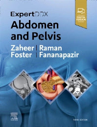 ExpertDDx: Abdomen and Pelvis (Hardback) 9780323878661