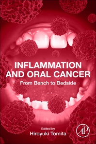 Inflammation and Oral Cancer; From Bench to Bedside (Paperback / softback) 9780323885263