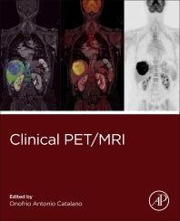 Clinical PET/MRI (Paperback / softback) 9780323885379