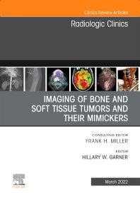 Imaging of Bone and Soft Tissue Tumors and Their Mimickers, An Issue of Radiologic Clinics of North America (Hardback) 9780323897488