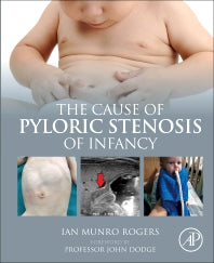 The Cause of Pyloric Stenosis of Infancy (Paperback / softback) 9780323897761