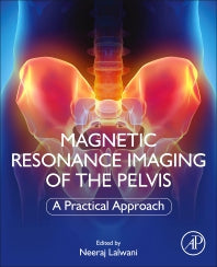 Magnetic Resonance Imaging of The Pelvis; A Practical Approach (Paperback / softback) 9780323898546