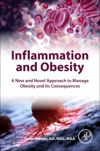 Inflammation and Obesity; A New and Novel Approach to Manage Obesity and its Consequences (Paperback / softback) 9780323909600