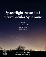 Spaceflight Associated Neuro-Ocular Syndrome (Paperback / softback) 9780323915243