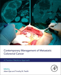 Contemporary Management of Metastatic Colorectal Cancer; A Precision Medicine Approach (Paperback / softback) 9780323917063