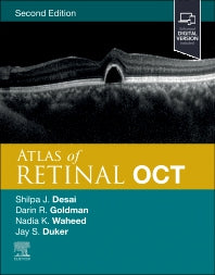 Atlas of Retinal OCT; Optical Coherence Tomography (Hardback) 9780323930437