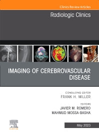 Imaging of Cerebrovascular Disease, An Issue of Radiologic Clinics of North America (Hardback) 9780323940092