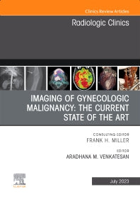 Imaging of Gynecologic Malignancy: The Current State of the Art, An Issue of Radiologic Clinics of North America (Hardback) 9780323940351