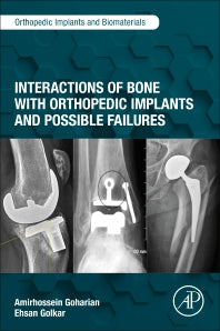 Interactions of Bone with Orthopedic Implants and Possible Failures (Paperback / softback) 9780323954105