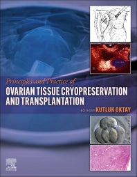 Principles and Practice of Ovarian Tissue Cryopreservation and Transplantation (Hardback) 9780323957533