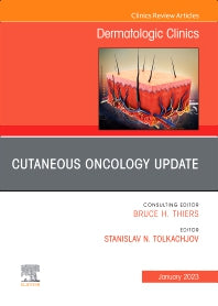 Cutaneous Oncology Update, An Issue of Dermatologic Clinics (Hardback) 9780323972840