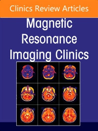 MR Imaging of the Adnexa, An Issue of Magnetic Resonance Imaging Clinics of North America (Hardback) 9780323987677