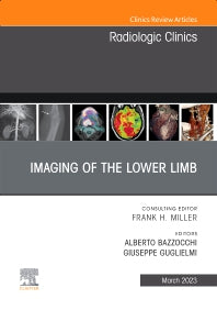Imaging of the Lower Limb, An Issue of Radiologic Clinics of North America (Hardback) 9780323987837
