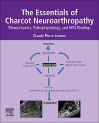 The Essentials of Charcot Neuroarthropathy; Biomechanics, Pathophysiology, and MRI Findings (Paperback / softback) 9780323993524