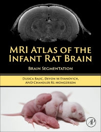 MRI Atlas of the Infant Rat Brain; Brain Segmentation (Hardback) 9780323997676