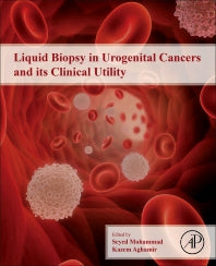 Liquid Biopsy in Urogenital Cancers and its Clinical Utility (Paperback / softback) 9780323998840