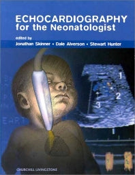 Echocardiography for the Neonatologist (Hardback) 9780443054808