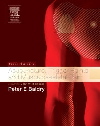 Acupuncture, Trigger Points and Musculoskeletal Pain (Hardback) 9780443066443