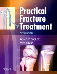 Practical Fracture Treatment (Paperback / softback) 9780443068768