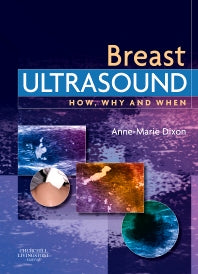 Breast Ultrasound; How, Why and When (Hardback) 9780443100765