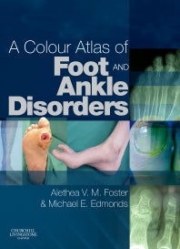 A Colour Atlas of Foot and Ankle Disorders (Hardback) 9780443102073