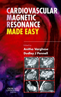 Cardiovascular Magnetic Resonance Made Easy (Paperback / softback) 9780443103018