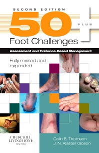 50+ Foot Challenges; Assessment and Evidence-Based Management (Paperback / softback) 9780443104022