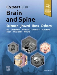ExpertDDx: Brain and Spine (Hardback) 9780443106941