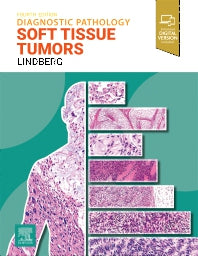 Diagnostic Pathology: Soft Tissue Tumors (Hardback) 9780443109362