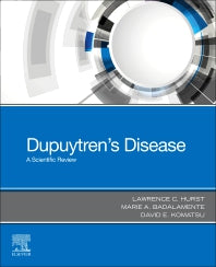 Dupuytren's Disease; A Scientific Review (Paperback / softback) 9780443114878