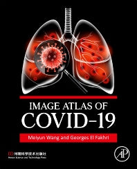 Image Atlas of COVID-19 (Paperback / softback) 9780443184932